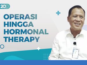 Sederet Cara Penanganan Kanker Payudara