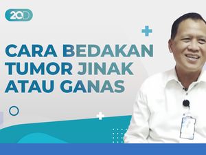 Kenali Perbedaan Tumor Payudara Jinak atau Ganas