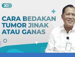 Kenali Perbedaan Tumor Payudara Jinak atau Ganas