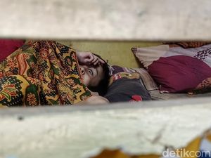 Perjuangan Ortu Rawat Anak Menderita Hidrosefalus dan Berharap Bantuan