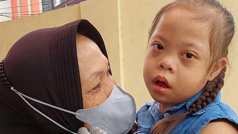 Mari Bantu Khairani, Anak Down Syndrome yang Sering Lukai Diri Sendiri