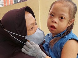 Mari Bantu Khairani, Anak Down Syndrome yang Sering Lukai Diri Sendiri