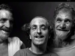 Kisah Kelam Inses yang Bikin Sekeluarga Cacat Mental-Fisik