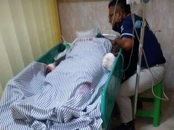 Korban Ledakan di Pasuruan Istri Pemilik Rumah, Luka Bakar Parah 80%