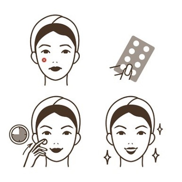 Mempercepat penyembuhan jerawat/foto: istockphoto.com Mempercepat penyembuhan jerawat