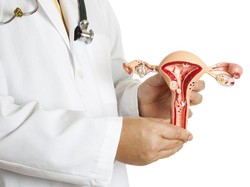 Ini 9 Penyebab Kista yang Wajib Kamu Waspadai