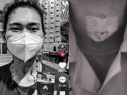 Wanita Jateng Kehilangan Suara gegara Pernah Jadi Social Smoker, Begini Kisahnya