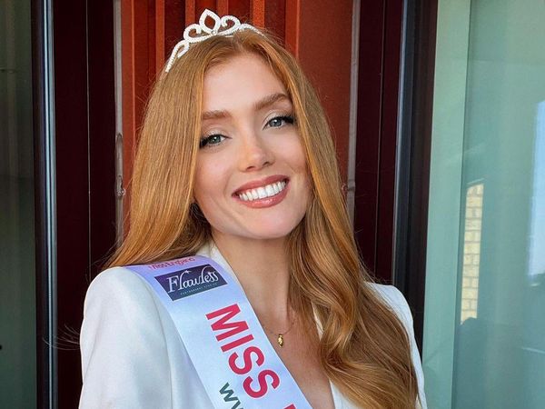 10 Pesona Jessica Gagen, Miss England Pertama yang Berambut Asli Merah