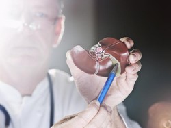 Obat Gagal Ginjal Akut dari Singapura Diuji Coba ke Pasien RSCM