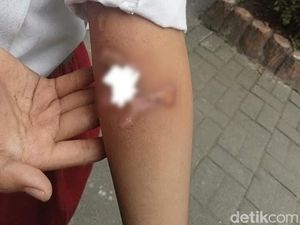 5 Fakta Pilu Bocah Yatim Gresik Dianiaya Kakak Tiri-Jadi Tukang Tambal Ban 5 Fakta Pilu Bocah Yatim Gresik Dianiaya Kakak Tiri-Jadi Tukang Tambal Ban