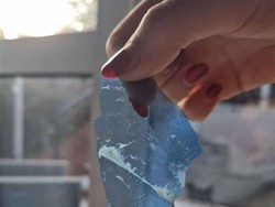 Potongan Plastik dalam Makanan Membuat Anak Ini Tersedak Sulit Bernafas