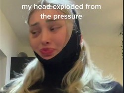 Terbang Habis Oplas Muka, Kepala Wanita Ini Rasanya Meledak