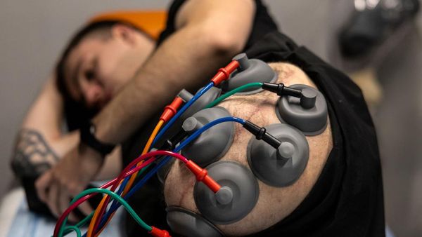 Rehabilitasi Tentara Ukraina yang Diamputasi