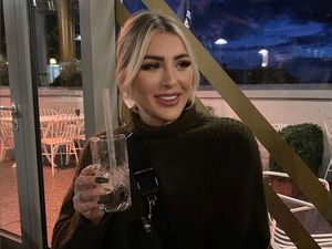 8 Potret Model yang Kepalanya Meledak di Pesawat Pascaoperasi Plastik