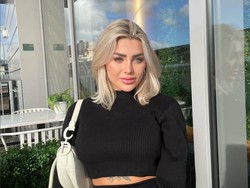 Ngeri, Kepala Model Ini Meledak di Pesawat Setelah Operasi Plastik