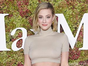 Lili Reinhart Ungkap Alami Kebotakan Rambut di Usia 27 Tahun Lili Reinhart Ungkap Alami Kebotakan Rambut di Usia 27 Tahun