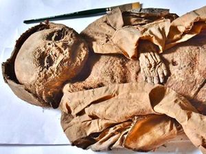 Mumi Balita Ungkap Kekurangan Sinar Matahari Sebabkan Kematian