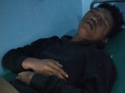 Pemuda Kediri Bersimbah Darah Jadi Korban Bacokan-Pukulan Gerombolan Motor