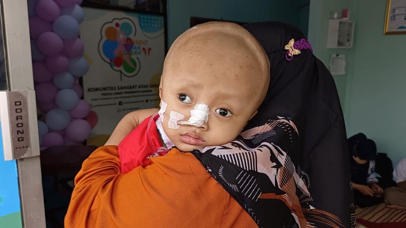 Mari Bantu Alfeandra, Bocah 3 Tahun yang Alami Kanker Otak Stadium 4