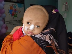 Mari Bantu Alfeandra, Bocah 3 Tahun yang Alami Kanker Otak Stadium 4