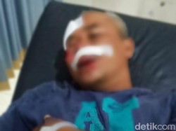 Wanita Banyuwangi Ungkap Detik-detik Menegangkan Lawan Penjambret