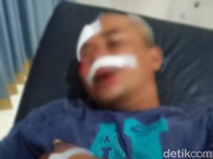 Wanita Banyuwangi Ungkap Detik-detik Menegangkan Lawan Penjambret Wanita Banyuwangi Ungkap Detik-detik Menegangkan Lawan Penjambret