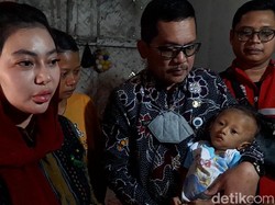 Divonis Gizi Buruk Berat, Balita Kurus di Brebes Dievakuasi ke RSUD