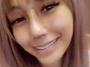 Artis Malaysia Operasi Hidung Sampai 4 Kali, Tindakan Oplasnya Dikecam Haram