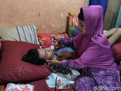 Kondisi Vicky Korban Kanjuruhan Sidoarjo: Tak Bisa Duduk-Makan Disuapi