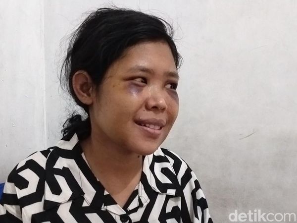 Senyum ART Rohimah yang Kembali Usai Disiksa Pasutri Sadis KBB