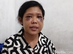 Firasat Kakak di Balik Tragedi Penyiksaan ART Rohimah di KBB