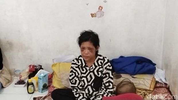 Rohimah, ART Garut yang disiksa majikan di Bandung Barat.