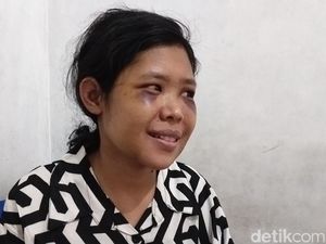 Senyum ART Rohimah Usai Bebas dari Majikan Penyiksanya Senyum ART Rohimah Usai Bebas dari Majikan Penyiksanya