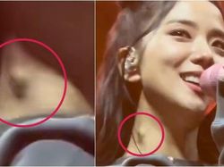 Benarkah Benjolan di Leher Jisoo BLACKPINK Pertanda Tumor? Ini Faktanya