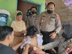 Memprihatinkan! Vicky Korban Kanjuruhan Alami Pembengkakan Otak