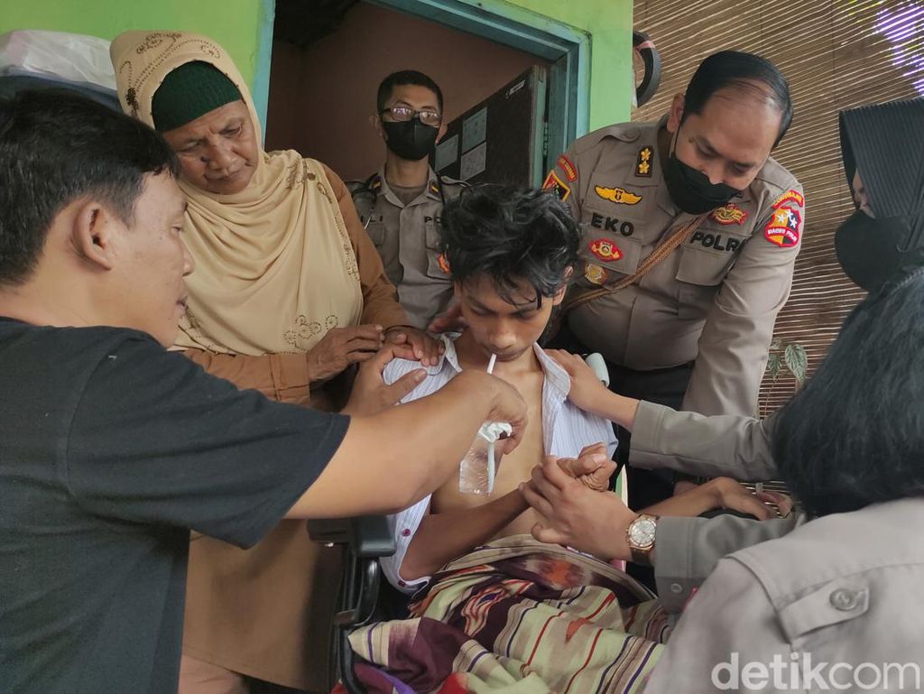 Pemulihan Syaraf Vicky, Korban Tragedi Kanjuruhan Butuh Waktu 6 Bulan