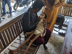 Belasan Tahun Terbaring Lemas di Tempat Tidur, Remaja Ini Butuh Bantuan