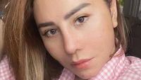 7 Foto Femmy Permatasari 23 Hari Pascaoperasi Plastik, Ini Wajah Barunya