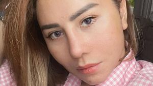 7 Foto Femmy Permatasari 23 Hari Pascaoperasi Plastik, Ini Wajah Barunya