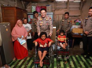 Kapolda Riau Janji Obati Kakak-Adik Penderita Tulang Rapuh di Pekanbaru