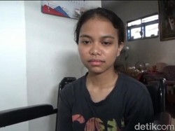 Derita Korban hingga 40 Hari Tragedi Kanjuruhan: Dian Masih Hilang Ingatan