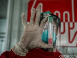 Kemenkes Sebut MB.1.1 Varian Dominan COVID-19 di Indonesia, XEC di Thailand-Malaysia