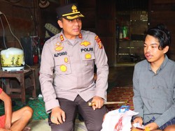 Begini Kondisi Terkini Pemuda yang Diterkam Beruang di Indragiri Hulu