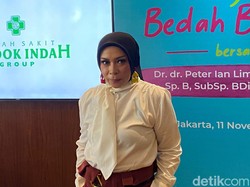Cerita Melly Goeslaw Jalani Operasi Bariatrik, Berhasil Turun 23 Kg dalam 3 Bulan