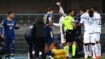 Detik-detik Kiper Polandia Alami Cedera Horor