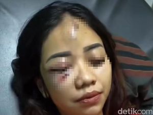 Heboh Wanita di Pekanbaru Pulang Babak Belur, Diduga Dianiaya Pacar