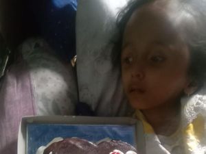 Berkat Sahabat Baik, Kondisi Anak dengan Kelainan Kerangka Kepala Membaik