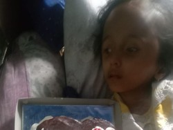 Berkat Sahabat Baik, Kondisi Anak dengan Kelainan Kerangka Kepala Membaik