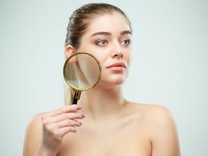 Ada Ribuan Tungai di Wajahmu, Lihat Fotonya di Sini!