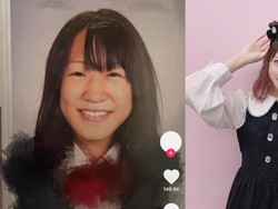 Influencer Ini Jalani Operasi Plastik Sejak Kelas 5 SD, Begini Penampakannya